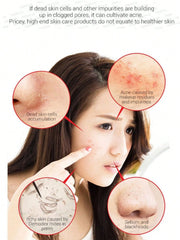 Some By Mi AHA BHA PHA 30 Days Miracle Cleansing Bar 106g