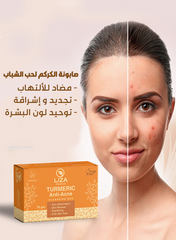 Liza Turmeric Anti Acne Cleansing Bar 70 Gm