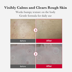 MEDICUBE Red Acne Body Peeling Shot 110g
