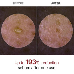 Dr.Melaxin Peel Shot Exfoliant Black Rice Ampoule 80ml
