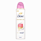 Dove Even Tone Deodorant Spray 150ml