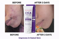 Shaan Cica Cream 60gm