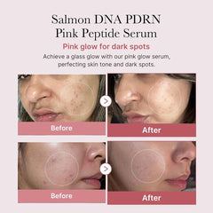 Medicube PDRN Pink Peptide Serum 30ml