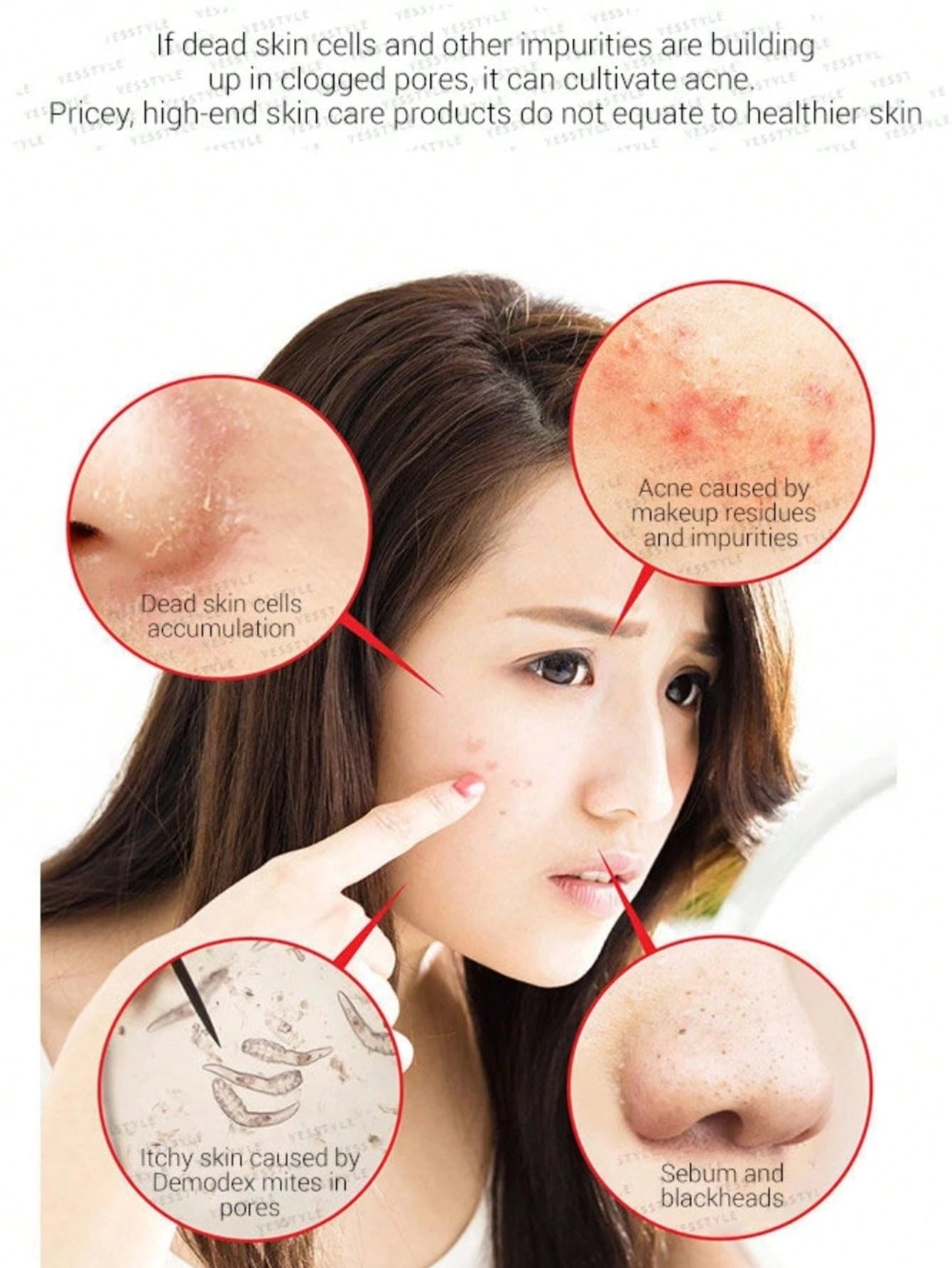 Some By Mi AHA BHA PHA 30 Days Miracle Cleansing Bar 106g