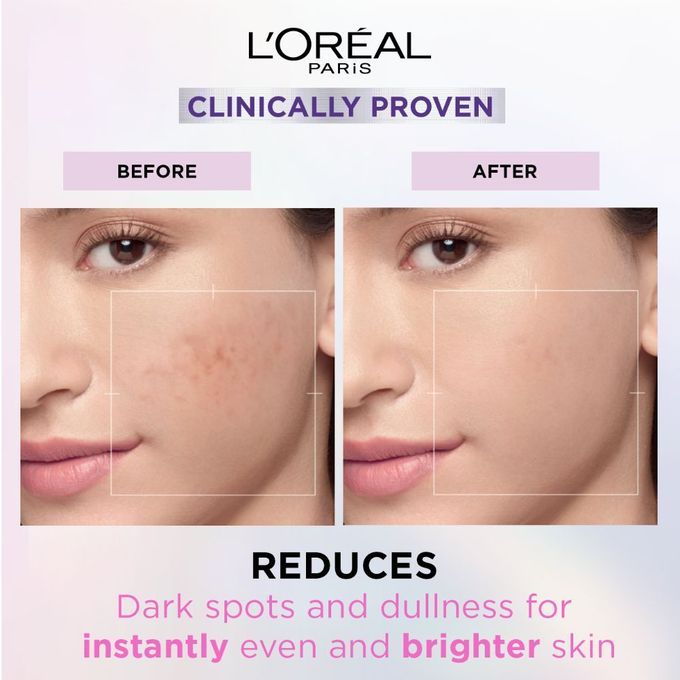 LOreal Paris Glycolic Bright Glowing Serum 30ml