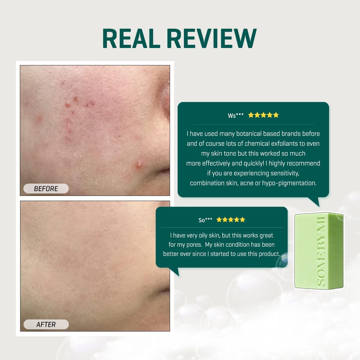 Some By Mi AHA BHA PHA 30 Days Miracle Cleansing Bar 106g