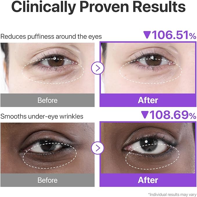 Numbuzin NMN Collagen Under Eye Patches with 50 Peptides