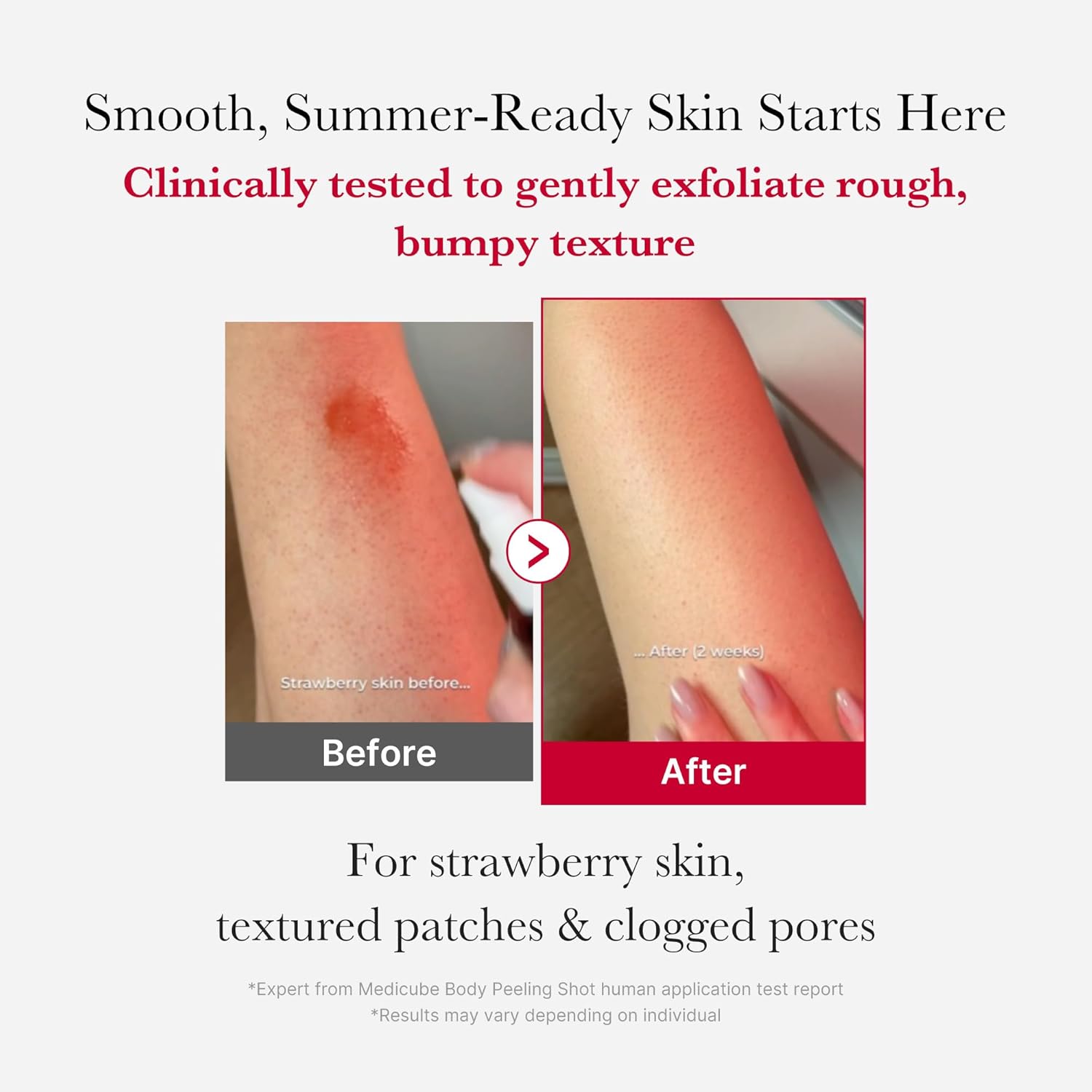 MEDICUBE Red Acne Body Peeling Shot 110g