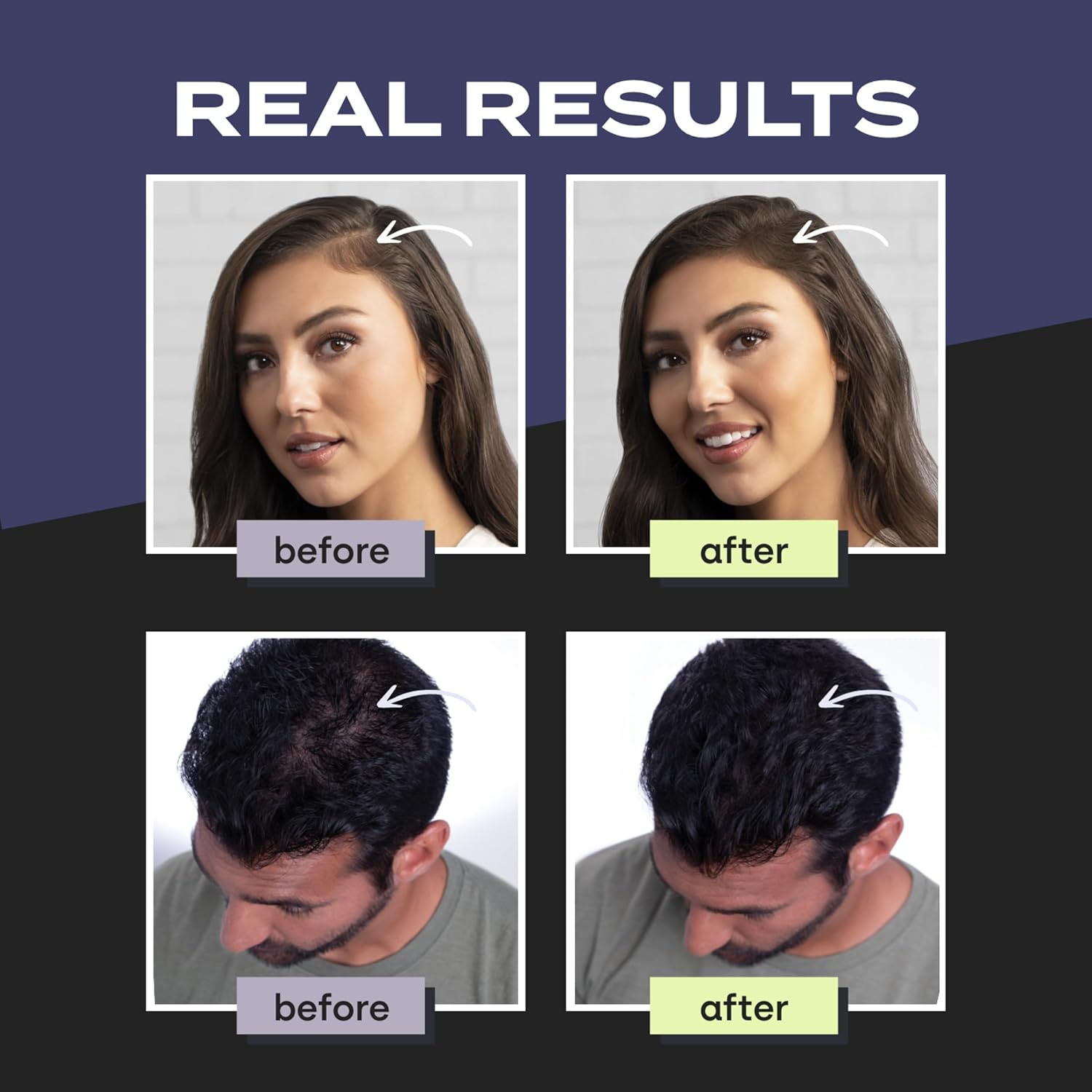 Toppik Hair Building Fibers 27.5g Black