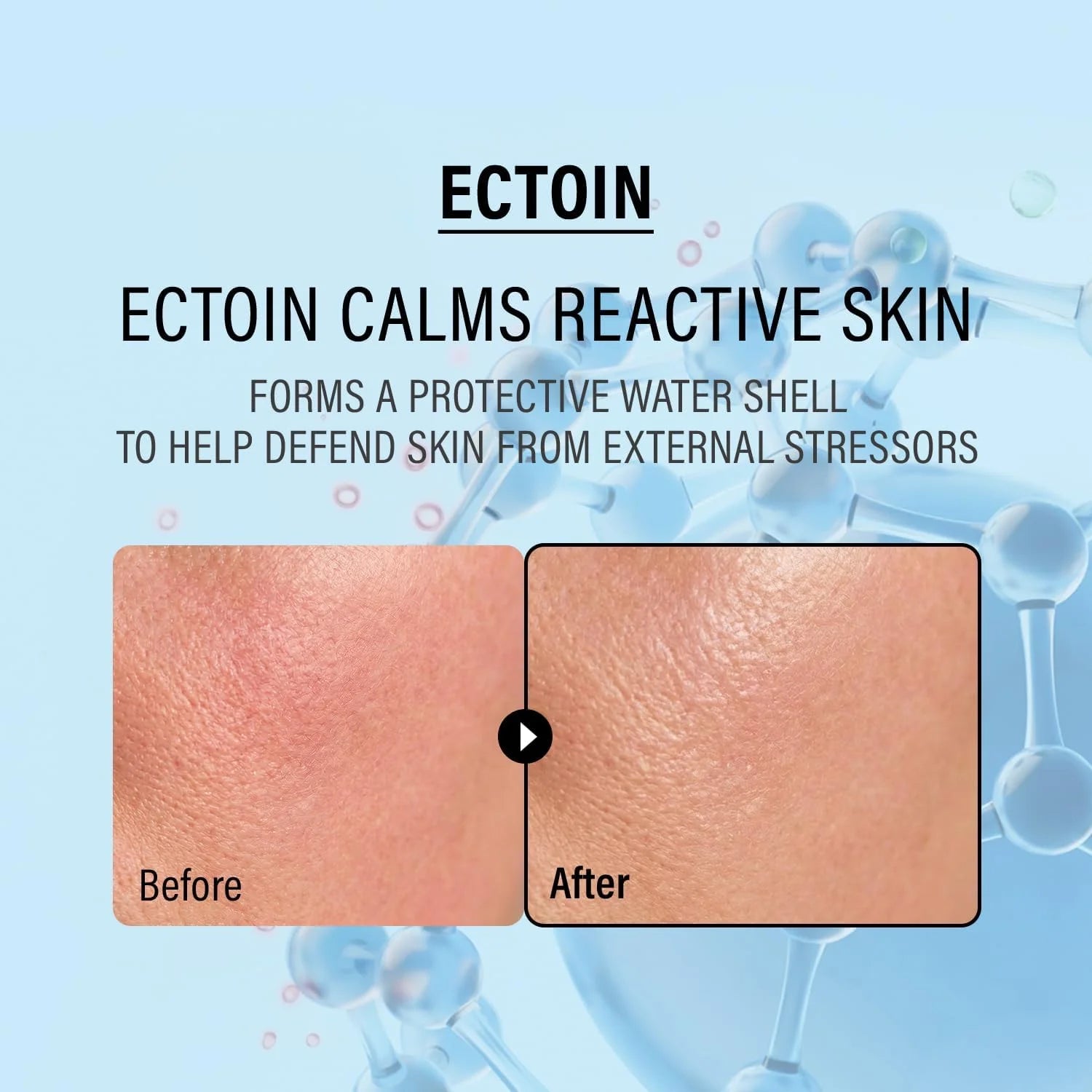 epii Double Up Cream Ectoin & Panthenol 50ml