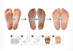 Purederm Foot Mask Exfoliating
