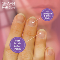 Shaan Nail Care Serum For Dry Damaged And Brittle Nails 4Ml