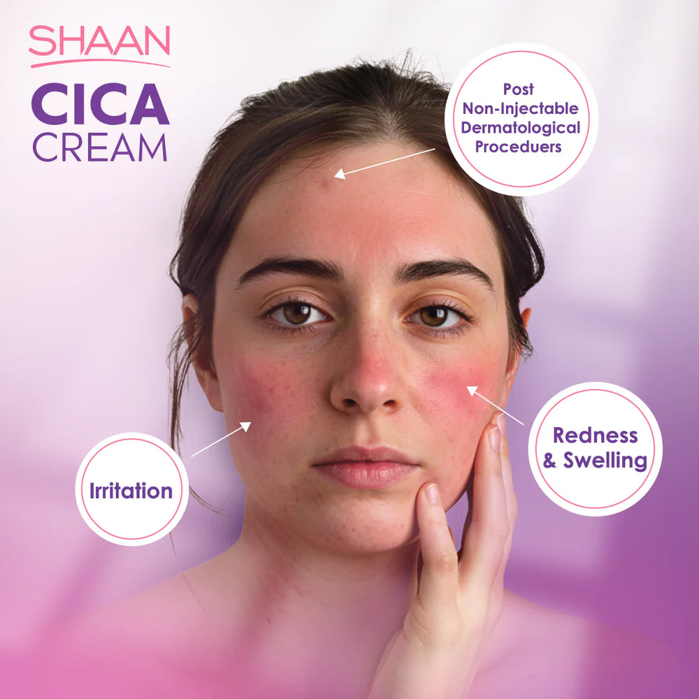 Shaan Cica Cream 60gm