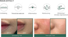 SOME BY MI AHA BHA PHA 30 Days Miracle Toner 150ml