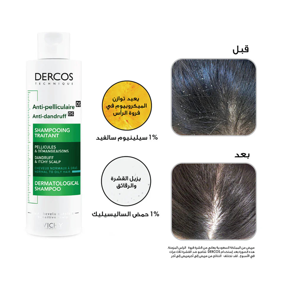 vichy Dercos Anti-Dandruff DS Shampoo For Dandruff Scalp Hair 200