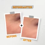 See Lit Vitamin C Skin lightening Serum 30ml 