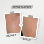 see lit serum advanced serum 30 ml