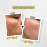 See Lit Skin Serum 30 ml Professional