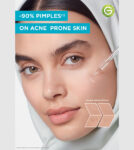 Garnier Facial Serum Rapid Purification Vitamin C for acne-prone skin 15 ml