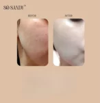 So Sandy Mela Off Cream Cold Peel 5 gm