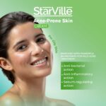 Starville acne-prone skin cream 60 gm