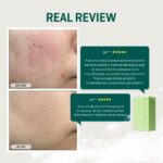 Some By Mi AHA BHA PHA 30 Days Miracle Cleansing Bar 106g