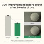 Axis-Y LHA Peel and Fill Pore Balancing Cream 50ml