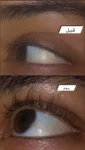 Raw African Eyelash Follicle Booster Gel 8 gm