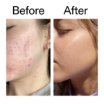 The Inkey list Niacinamide Serum 30ml